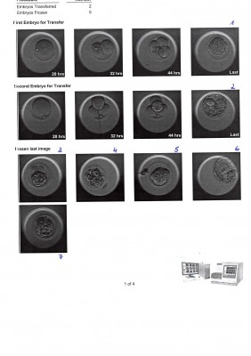 Blastozysten zum Transfer und Frozen Blastozysten nummeriert.JPG