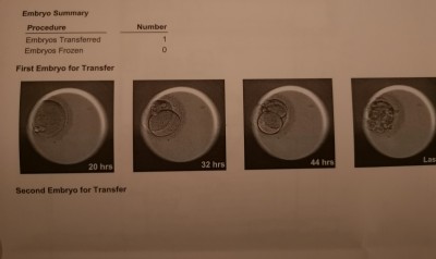 Embryoscope Bild.jpg