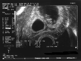 Laut Ultraschall &amp;quot;Twin B&amp;quot;