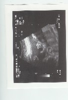 Ultraschall20060313.jpg