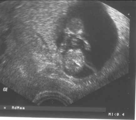Emsius20060403.jpg