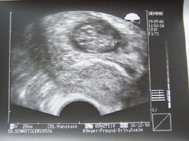 4. US 002 2.jpg