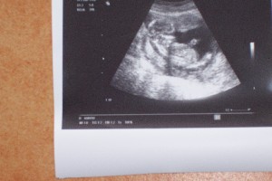 Das US Bild ist jetzt aus der 16. Woche