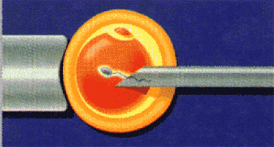 ICSI Bild 12.jpg