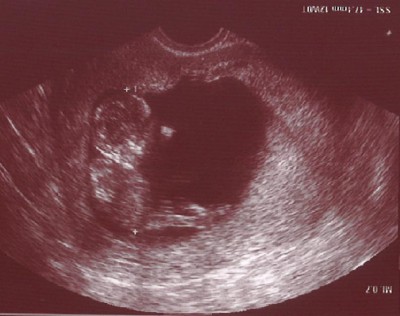 Krümelchen bei 11+6 und 47,4mm