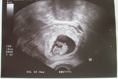 Baby 3. US.jpg