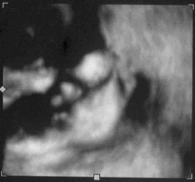 US 07.04.10 29+2 SSW 4 komprimiert.jpg