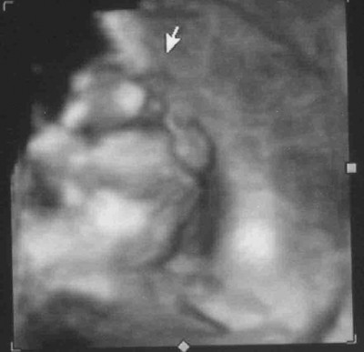 US 07.04.10 29+2 SSW 3 komprimiert.jpg