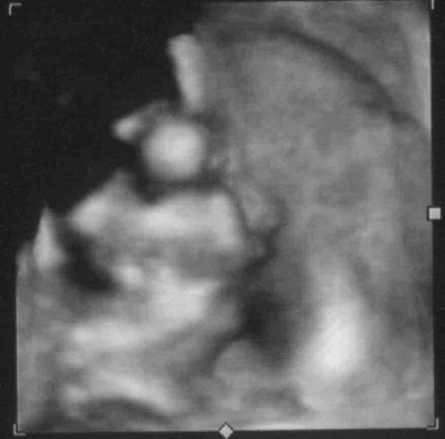 US 07.04.10 29+2 SSW 1 komprimiert.jpg