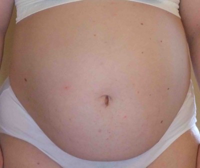 Bauchbild SSW29+6 Vorne komprimiert.jpg