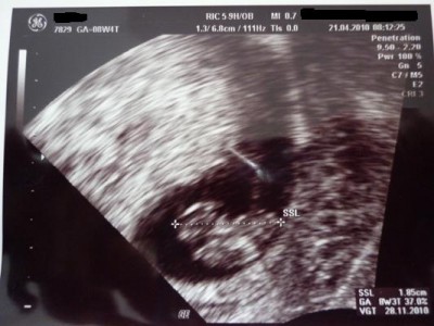 Bild 1.JPG