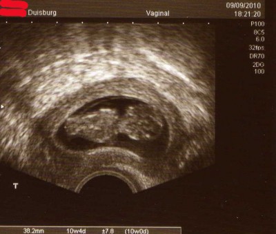 Baby002.jpg