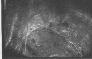 US zugeschnitten.JPG