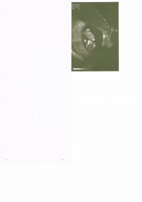 Krümel SSW 10+1.JPG