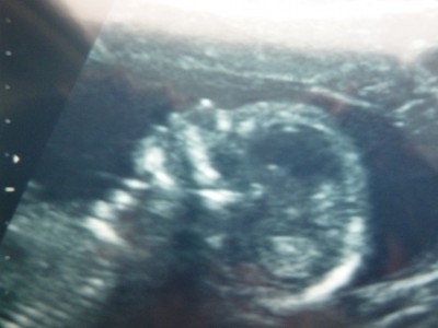 Baby mit geöffnetem Mund