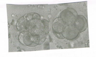 CCI28012011_00000.bmp.jpg