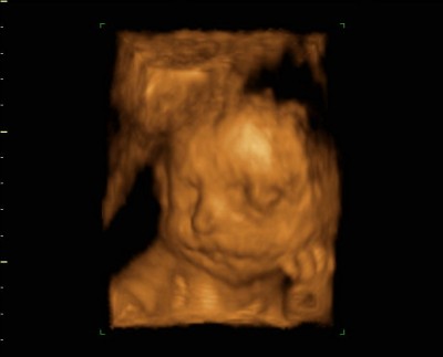 der kleine 28ssw.jpg