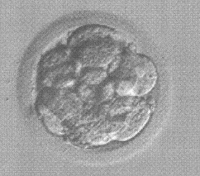 3D_Embryo_April2015_Freigestellt.jpg