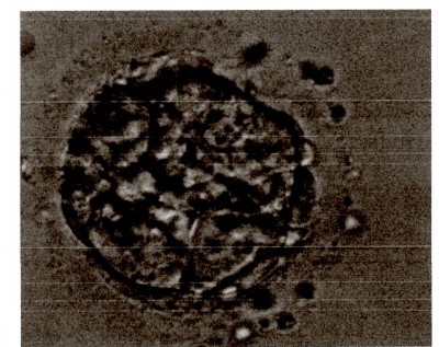 Embryo.jpg