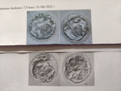 Embryonen November2020 und September 2021